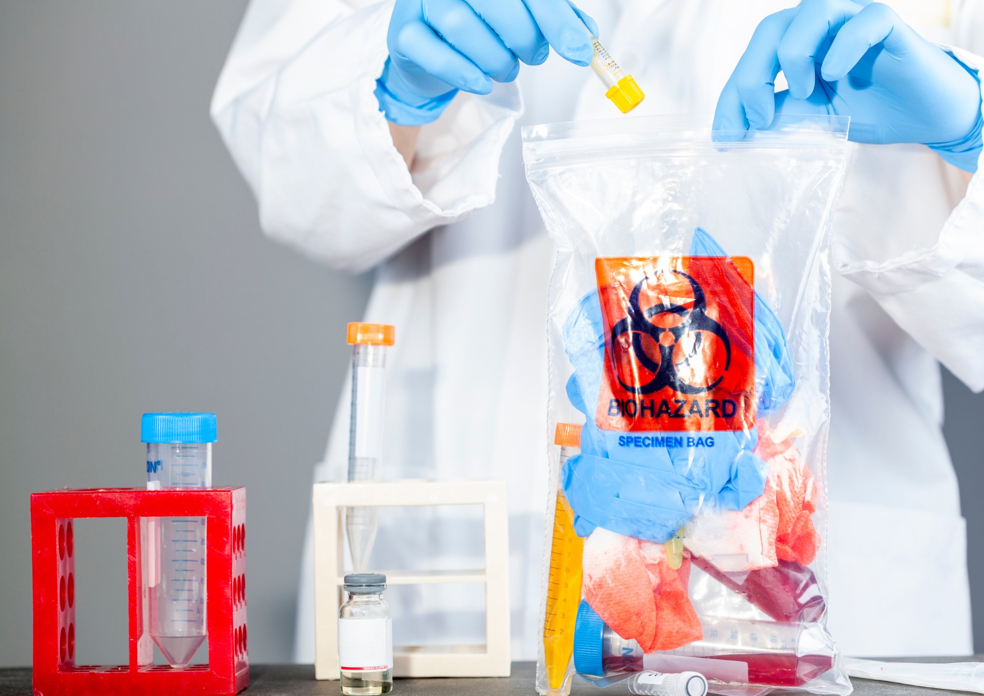 Read more about the article Why Industries Need Professional Hazardous Waste Disposal Partners for Safer Operations